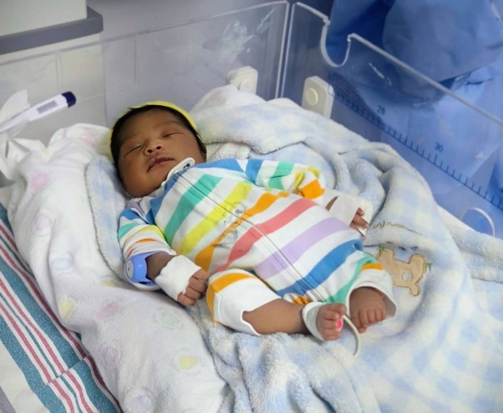 Premature baby in Belize wearing TempWatch in incubator