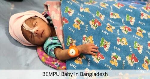 Bangladesh — Baby wearing TempWatch