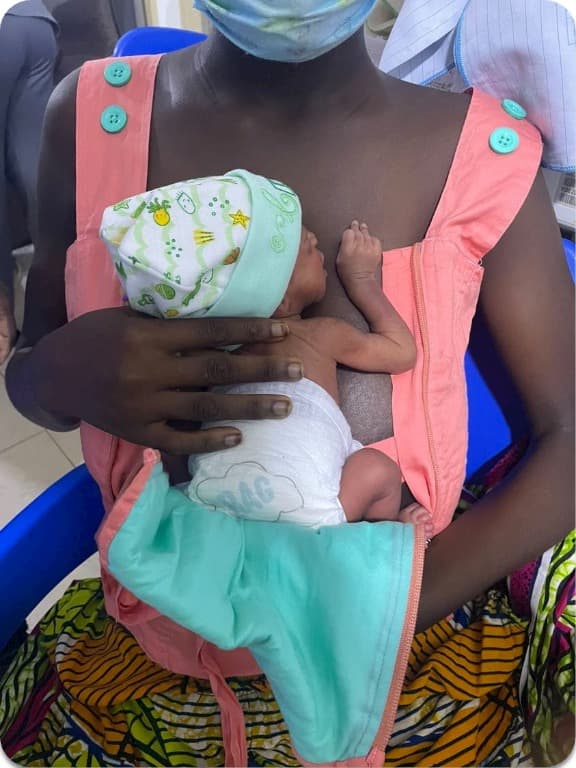 Ghana — KMC program using KangaSling