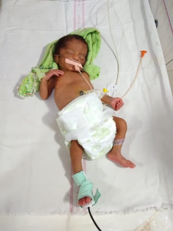 Preterm newborn receiving apnea monitoring in a high-load NICU