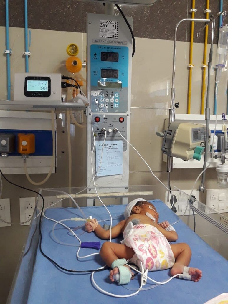 Preterm newborn receiving apnea monitoring in a high-load NICU