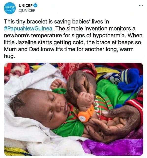 UNICEF tweet: 'This tiny bracelet is saving babies' lives in Papua New Guinea'